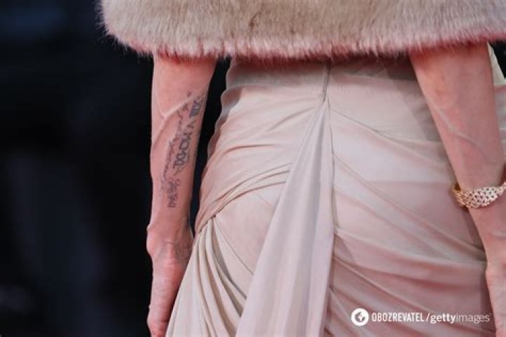 Surgeon Reveals If She Should Be Worried – Hollywood Life