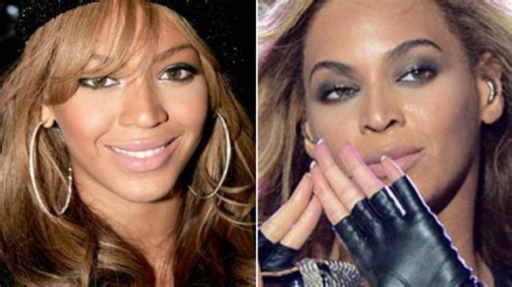 Beyonce Nose Job Rumors — Did She Go Under The Knife? Experts Weigh In – Hollywood Life