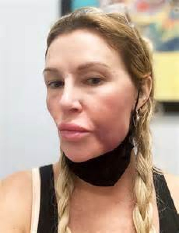 RHOBH’s Brandi Glanville Reveals She ‘Collapsed’ and Her Son ‘Had to Call 9-1-1 for Help’