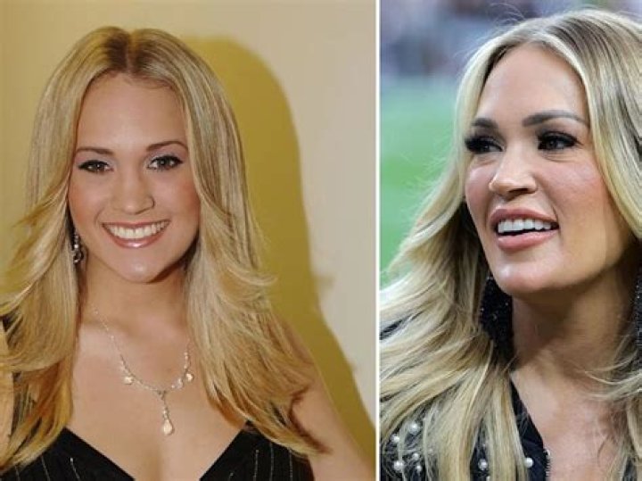 Carrie Underwood’s Transformation — PICS