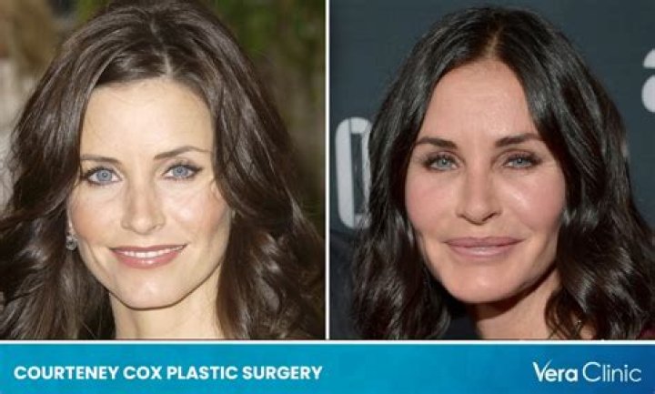 [PICS] Courteney Cox’s Puffy Face — Has Actress Had Plastic Surgery? – Hollywood Life