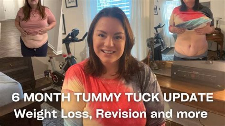 Dolores Catania On Tummy Tuck & Diet That Gave Her Amazing Results – Hollywood Life