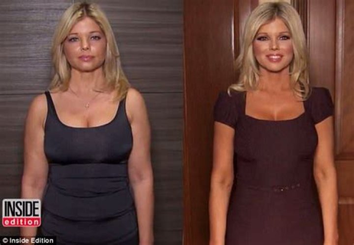 Donna D’Errico’s Plastic Surgery — See Her Body Transformation – Hollywood Life