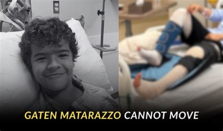 All About His Cleidocranial Dysplasia Battle – Hollywood Life