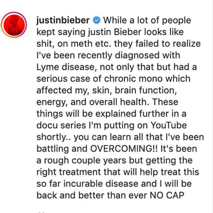 Confirms Lyme Disease – Hollywood Life