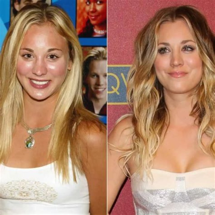 Kaley Cuoco-Sweeting: My Breast Implants Are ‘The Best Thing Ever’