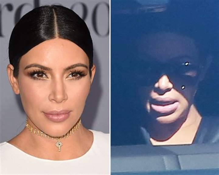 [PIC] Kim Kardashian Lip Fillers — Did She Get Any While Pregnant? – Hollywood Life