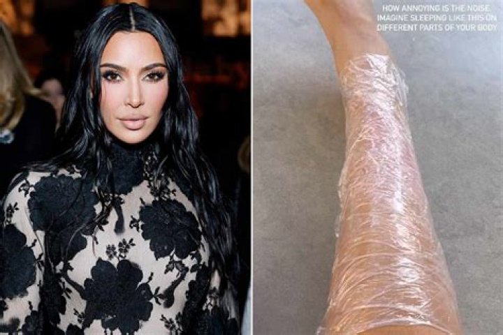 Kim Kardashian Reveals ‘Painful’ Psoriasis Flare-Up: It’s ‘All up My Leg’