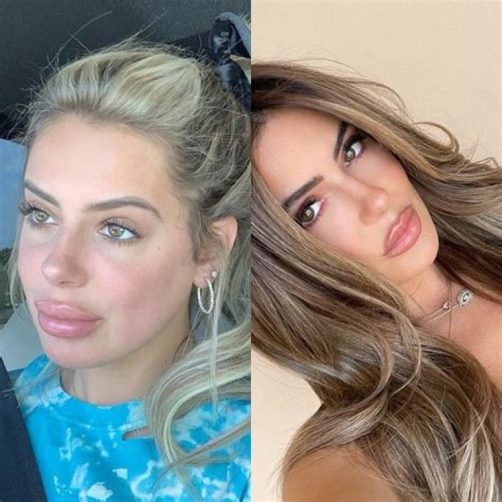 Kim Zolciak Reveals Daughter Brielle, 23, Got Her Lips Done Again: ‘There’s A Fine Balance’