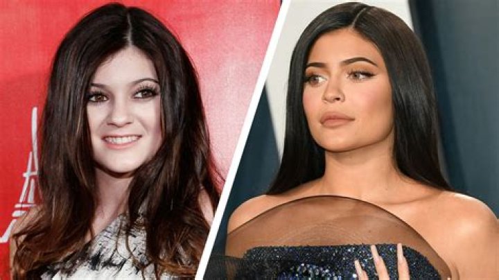 Has She Had Work Done? — Photos – Hollywood Life