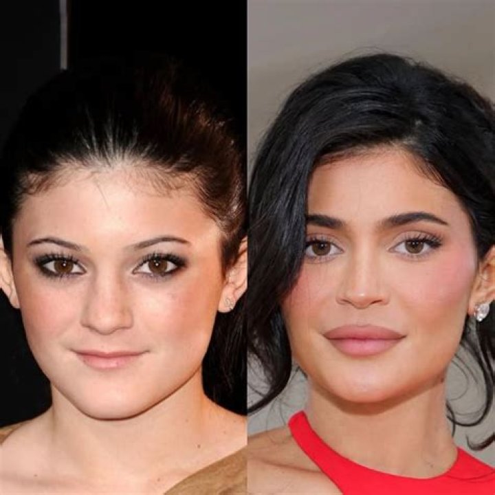 Kylie Jenner Confesses She Felt ‘Unkissable’ As A Teen Before Getting Lip Fillers