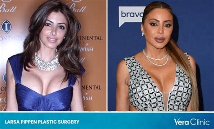 Larsa Pippen Talks Plastic Surgery, Butt Lift – Before & After Photos – Hollywood Life