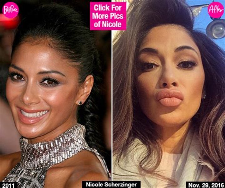 Nicole Scherzinger’s Lips Look Huge In New Selfie & Fans Wonder If She Got Lip Injections