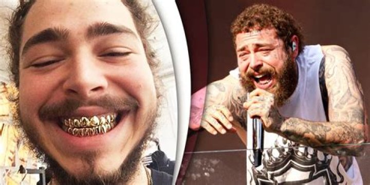 Post Malone Shows Off Diamond Fangs In Smile Makeover – Hollywood Life