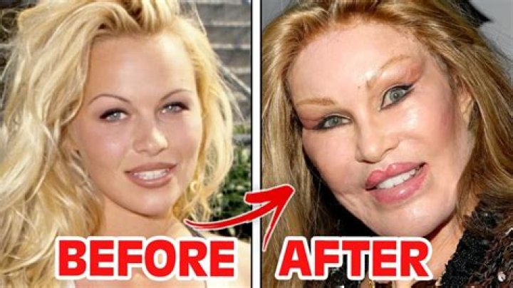 Stars Admitting Plastic Surgery — Which Celebrities Admit Going Under? – Hollywood Life