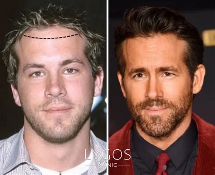 18 Stars Who Look Unrecognizable After Extreme Makeovers — See Pics