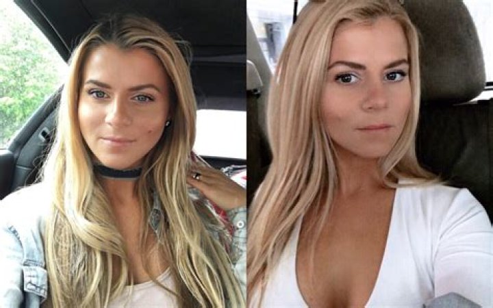 ‘The Situation’s Fiancee Lauren Pesce Gets A Nose Job — Pic – Hollywood Life